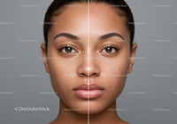 Skincare Transformation of a Woman with Clear and Acne-prone Skin