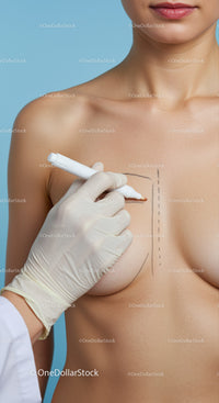Female Patient Undergoing Breast Augmentation with Surgical Markings