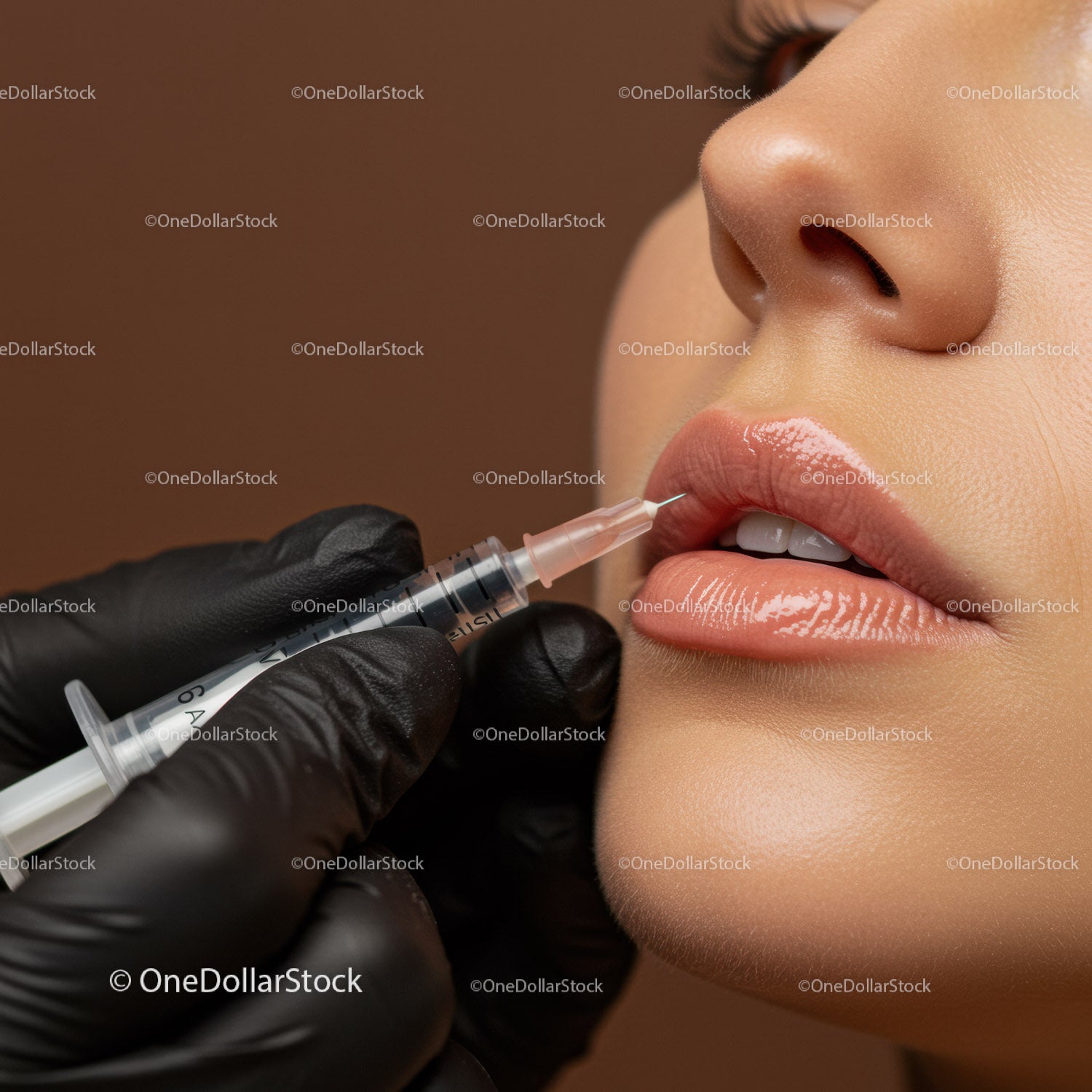 Close-Up of Lip Injection Procedure by Aesthetic Specialist