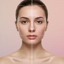 Close-Up of Young Woman with Clear and Acne-Prone Skin Showing Skin Improvement