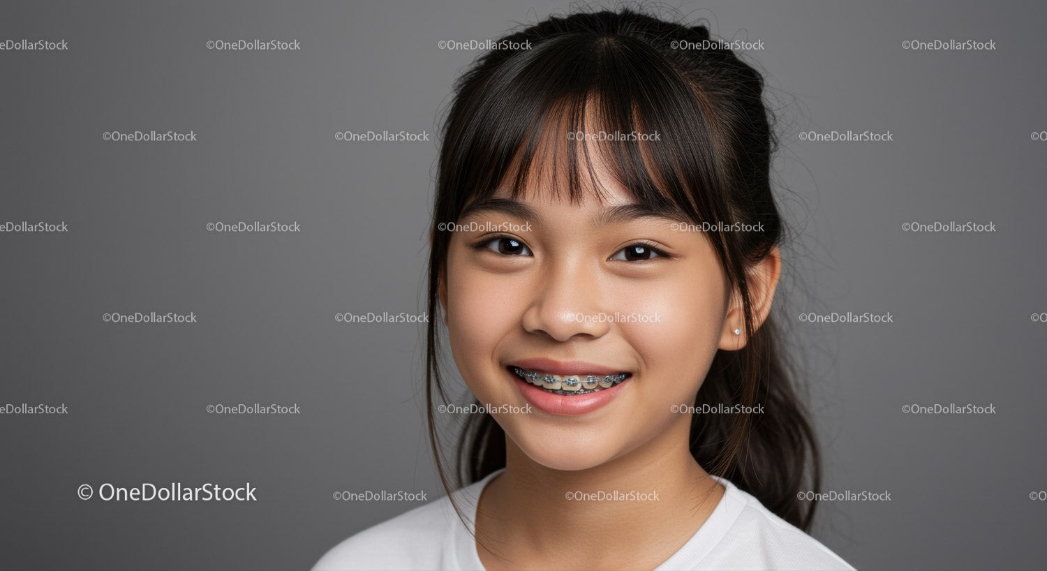 Happy Teenage Girl with Braces and Bright Smile
