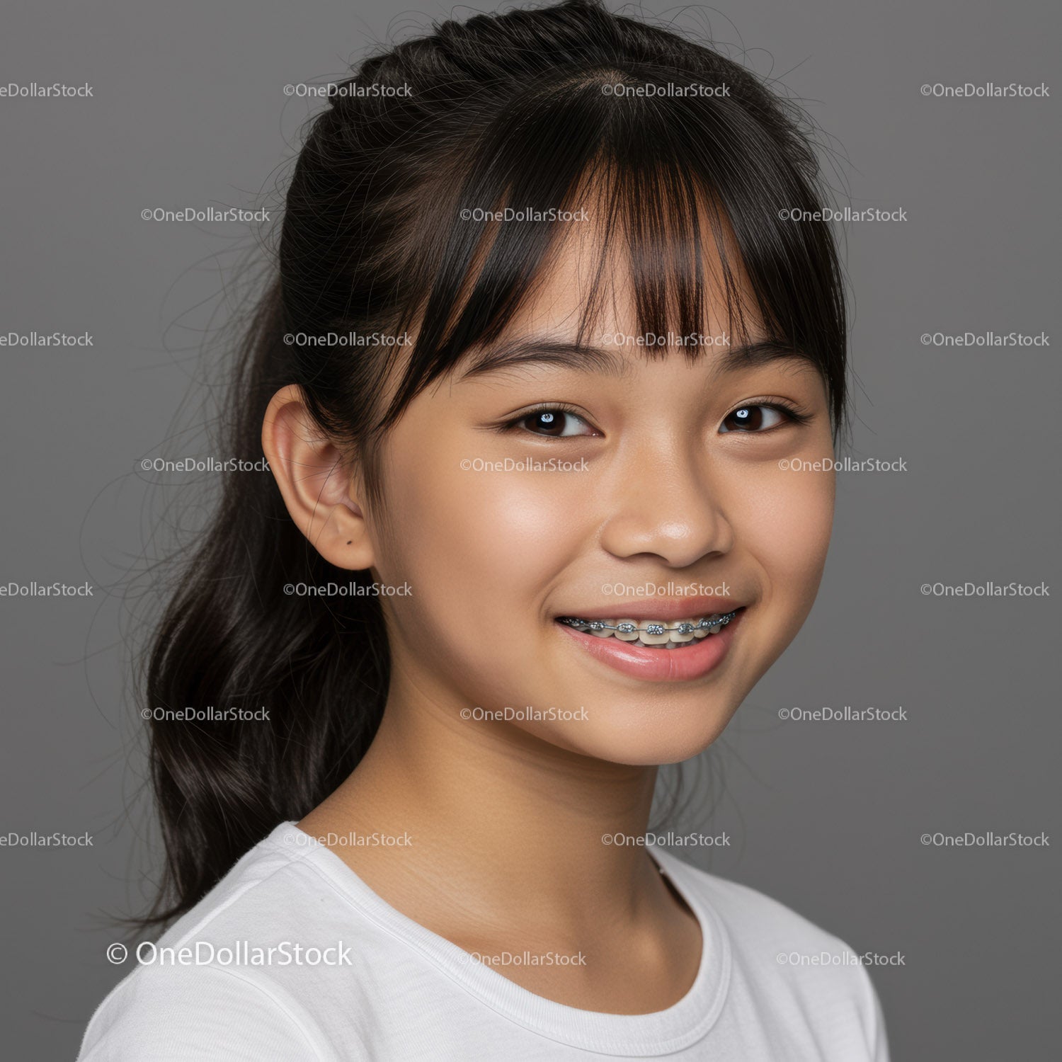 Smiling Teenage Girl with Dental Braces Portrait