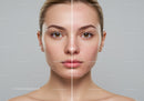 Before and After Skincare Treatment for Acne and Skin Rejuvenation