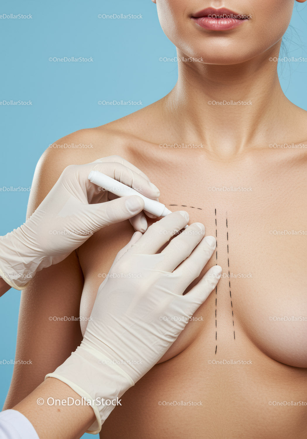 Woman Undergoing Breast Surgery in Clinical Environment