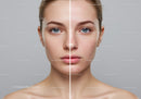 Before and After Skin Rejuvenation Facial Treatment