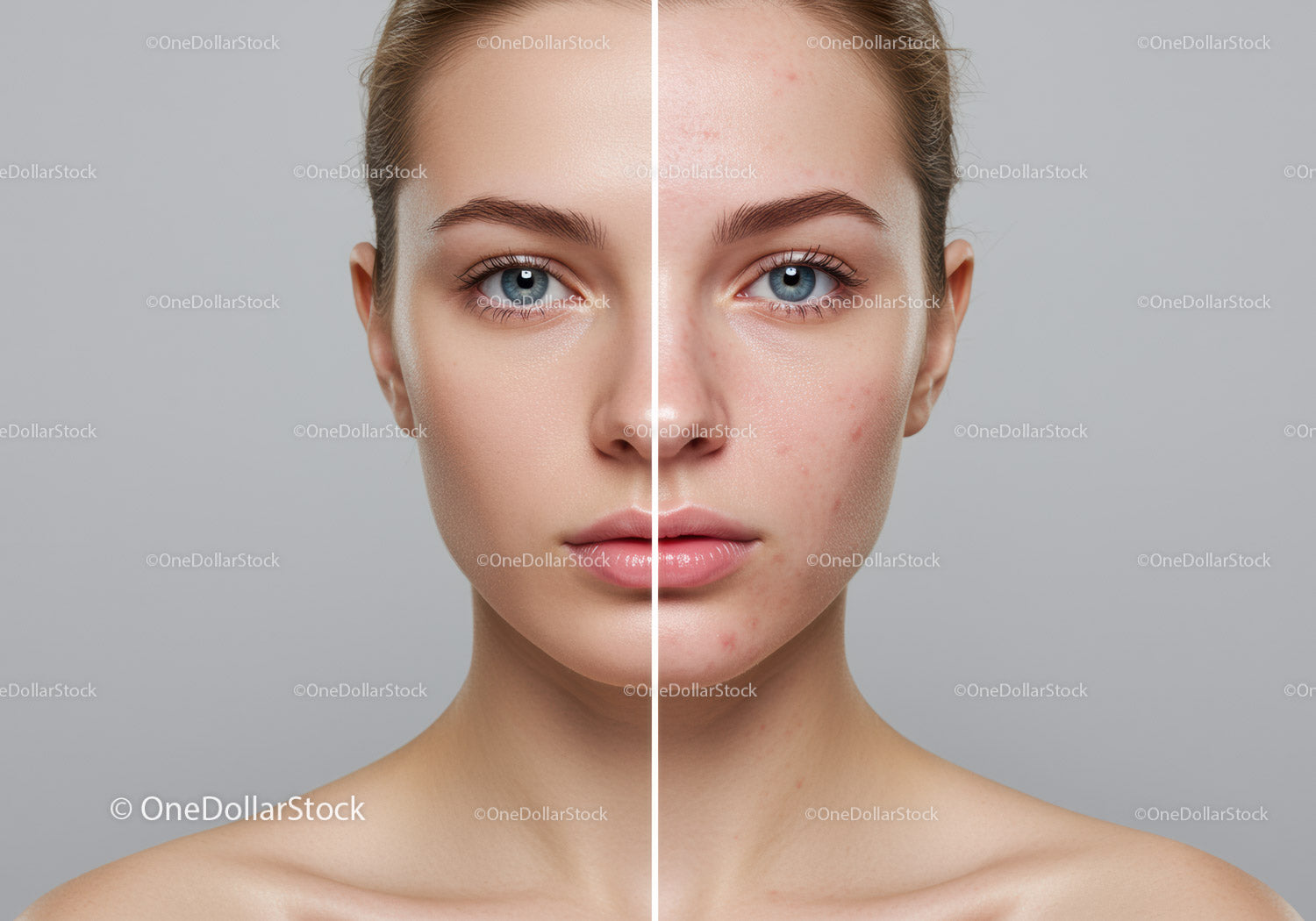 Before and After Skin Rejuvenation Facial Treatment