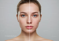 Portrait of a Woman Showing Clear Skin and Skin Improvement