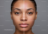 Close-Up of Young Woman's Face Showing Before and After Skincare Treatment