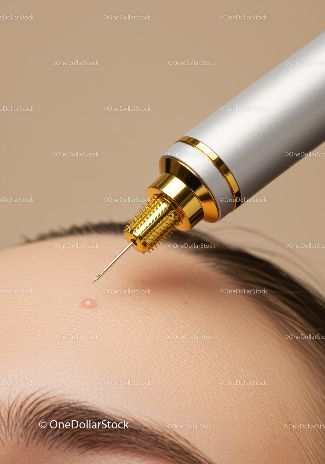 Close-Up of Dermatological Skin Treatment with Advanced Cosmetic Device