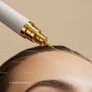 Close-Up of a Botox Injection Being Applied on Forehead