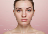 Portrait of a Young Woman with Clear and Acne-Prone Skin Side by Side